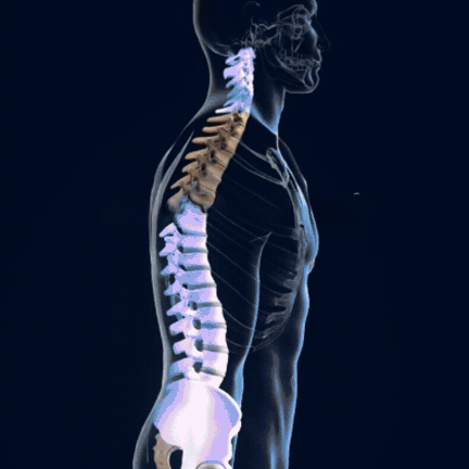 Correctlyne™ | Correct Your Posture